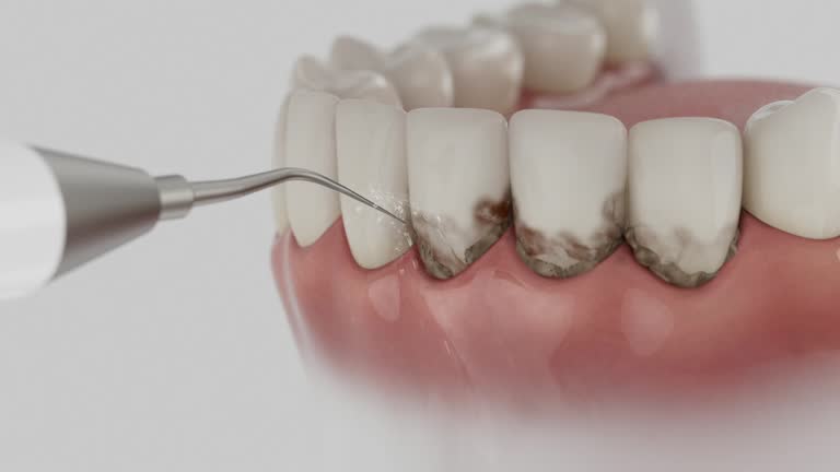 Reliable Wisdom Tooth Removal contractor in Loudon County County, TN by Dentist Open Now
